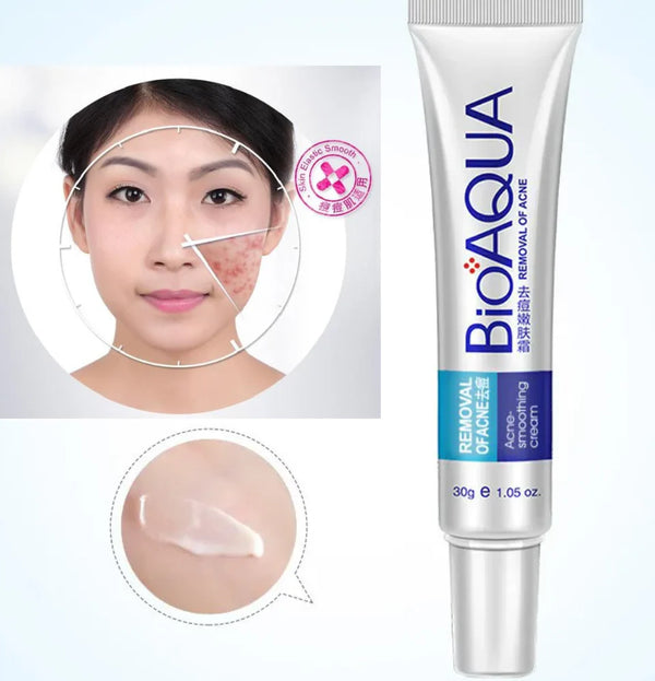 Bioaqua Removal Of Acne Cream_nuvaripk_pakistan